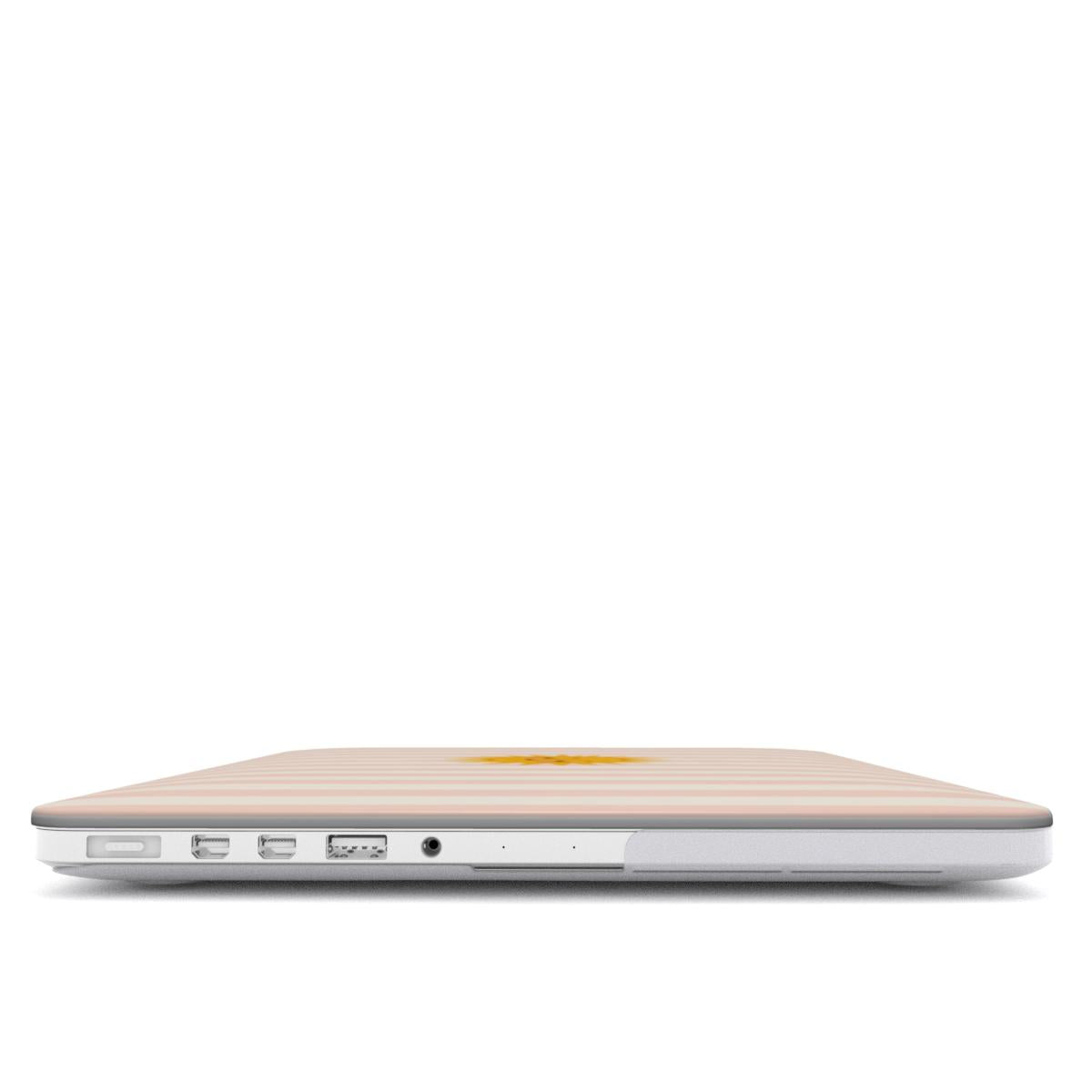 Sunshine Stripe MacBook case — hard-shell laptop cover, side view with ports