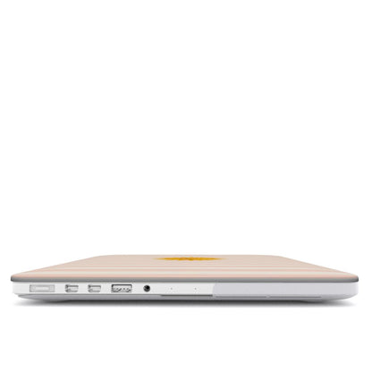 Sunshine Stripe MacBook case — hard-shell laptop cover, side view with ports
