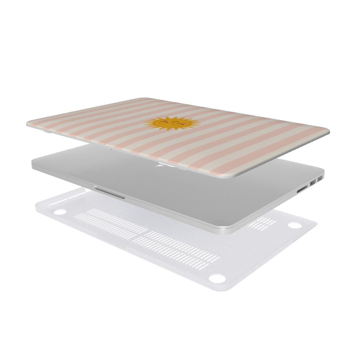 Sunshine Stripe MacBook case — hard-shell laptop cover, two-piece shell view