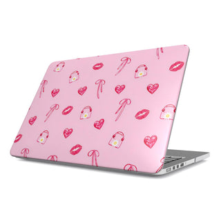 Lips & Bows MacBook case — hard-shell laptop cover, angled lid view