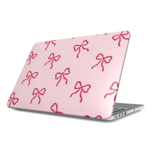 Red Bows MacBook case — hard-shell laptop cover, angled lid view