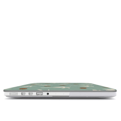 Palm Tree MacBook case — hard-shell laptop cover, side view with ports
