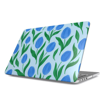 Painted Tulip MacBook case — hard-shell laptop cover, angled lid view