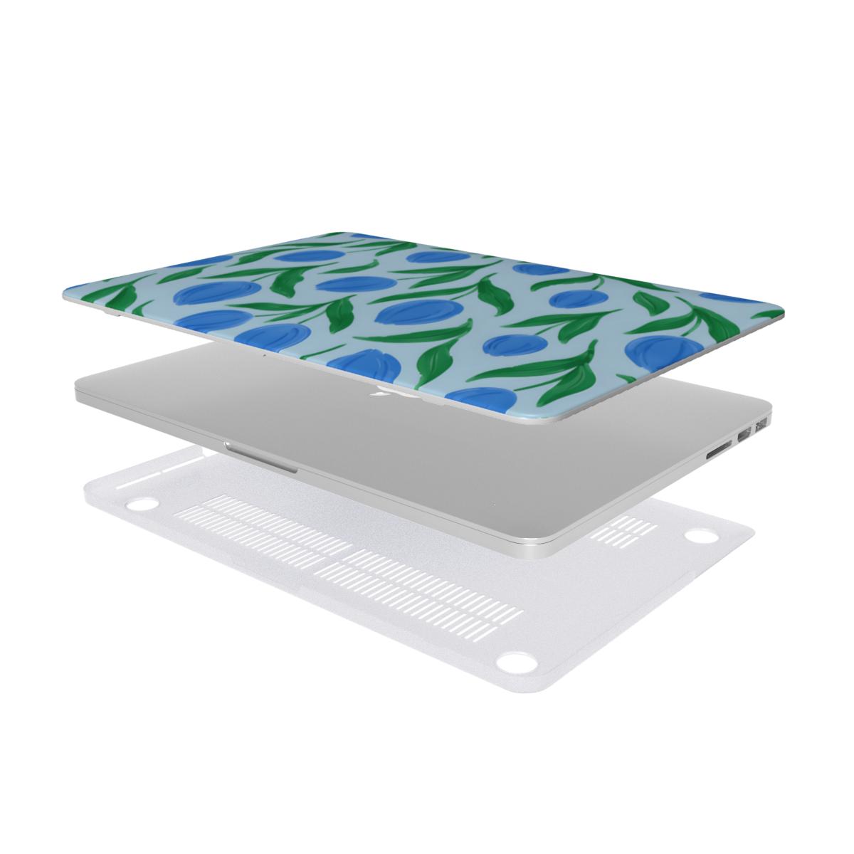 Painted Tulip MacBook case — hard-shell laptop cover, two-piece shell view