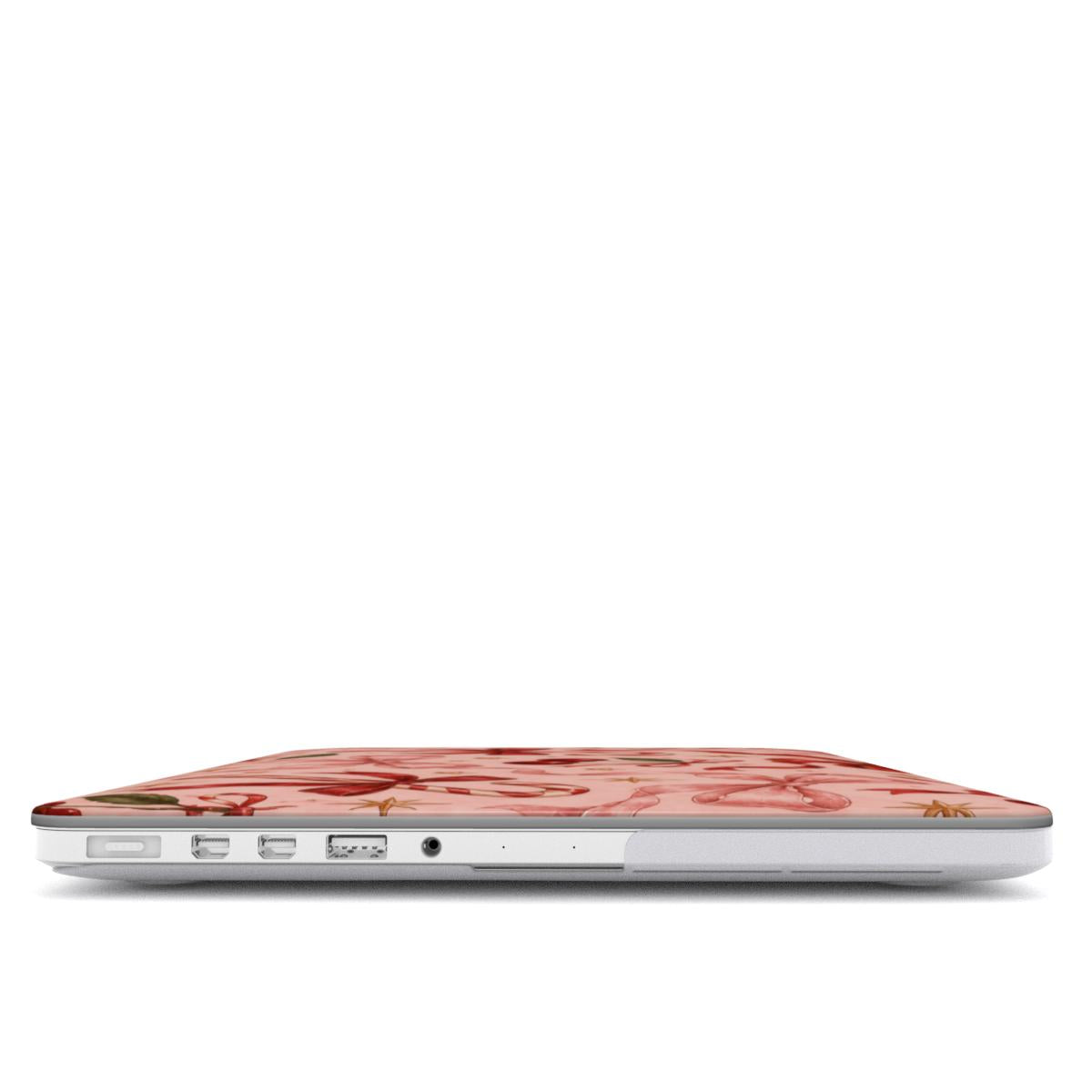 Candy Canes & Cherries MacBook case — hard-shell laptop cover, side view with ports