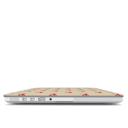 Tiny Red Bows MacBook case — hard-shell laptop cover, side view with ports