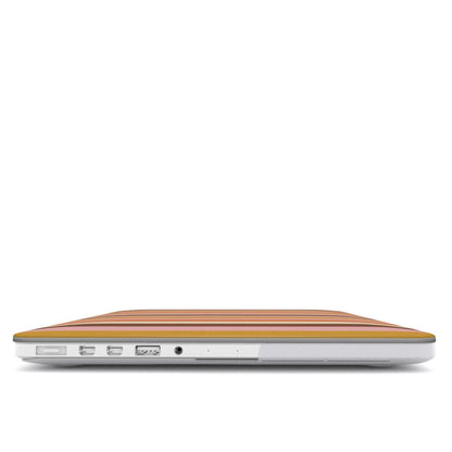 Retro Candy Stripe MacBook case — hard-shell laptop cover, side view with ports