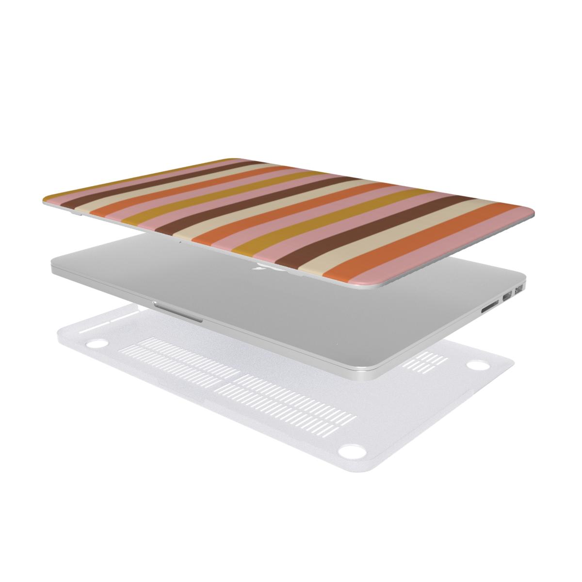 Retro Candy Stripe MacBook case — hard-shell laptop cover, two-piece shell view