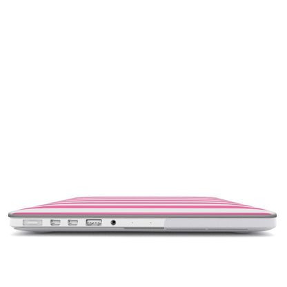Pink Cabana Stripe MacBook case — hard-shell laptop cover, side view with ports