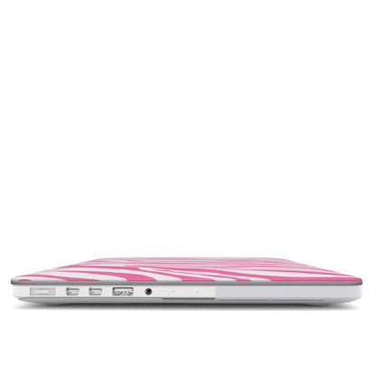 Pink Zebra MacBook case — hard-shell laptop cover, side view with ports