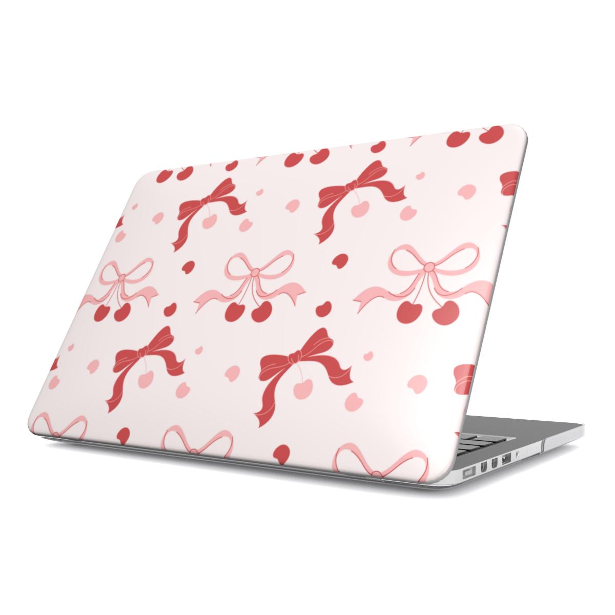 Cherry Bows MacBook case — cherry coquette, hard-shell laptop cover, angled lid view