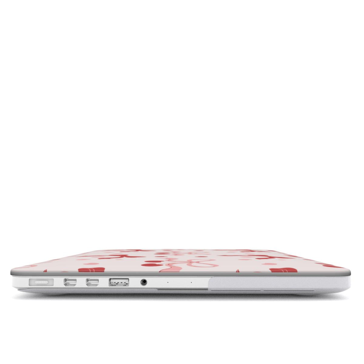 Cherry Bows MacBook case — hard-shell laptop cover, side view with ports