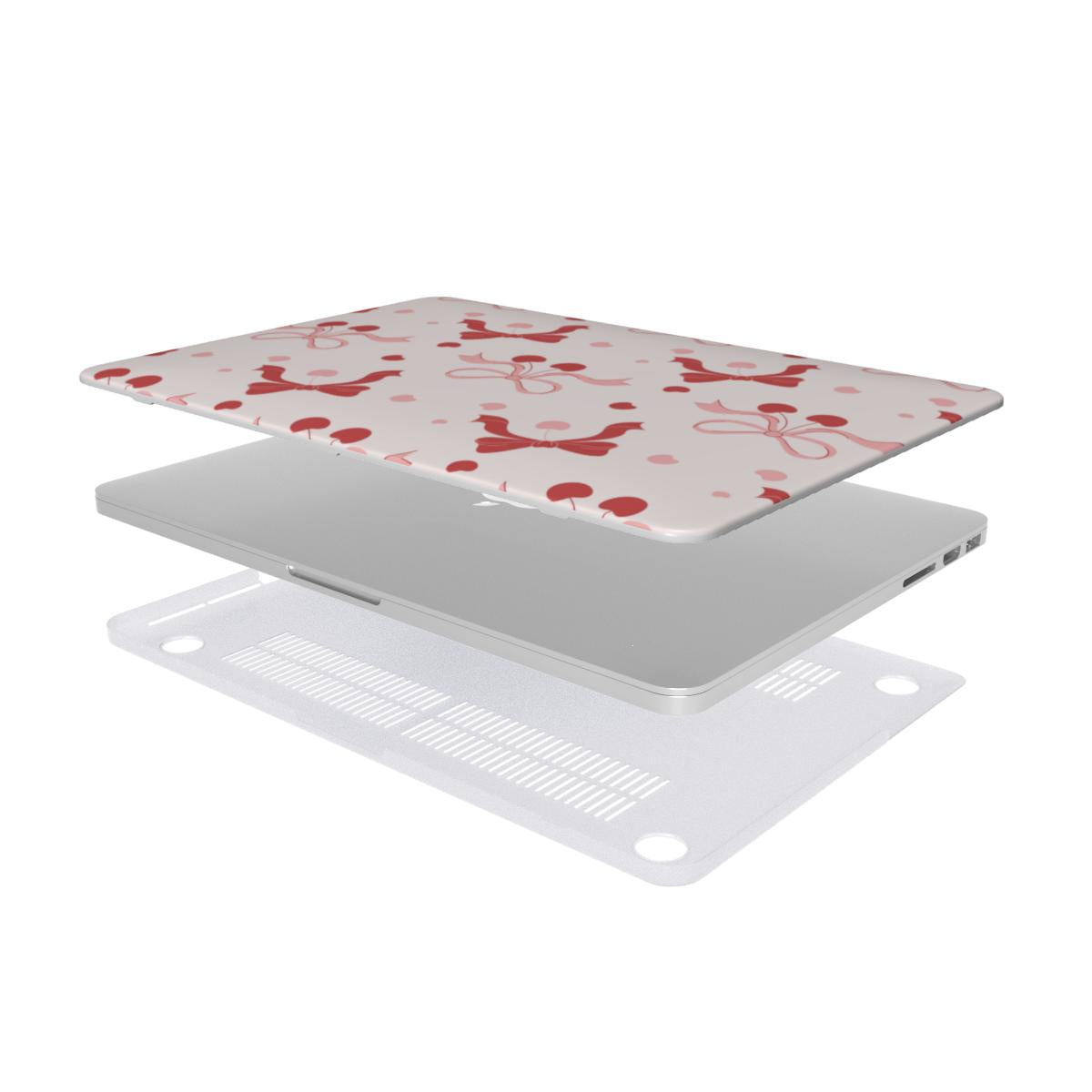 Cherry Bows MacBook case — hard-shell laptop cover, two-piece shell view