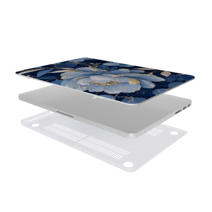 Midnight Blue Peony MacBook case — hard-shell laptop cover, two-piece shell view