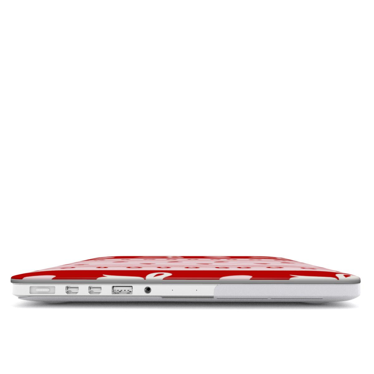 Bows & Hearts Stripe MacBook case — hard-shell laptop cover, side view with ports
