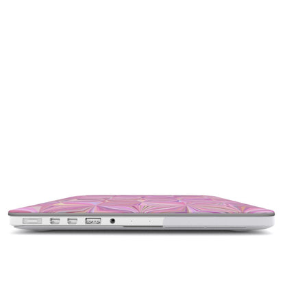 Pink Prism MacBook case — hard-shell laptop cover, side view with ports