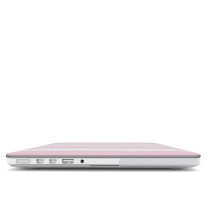 Pink Sparkle Stripe MacBook case — hard-shell laptop cover, side view with ports